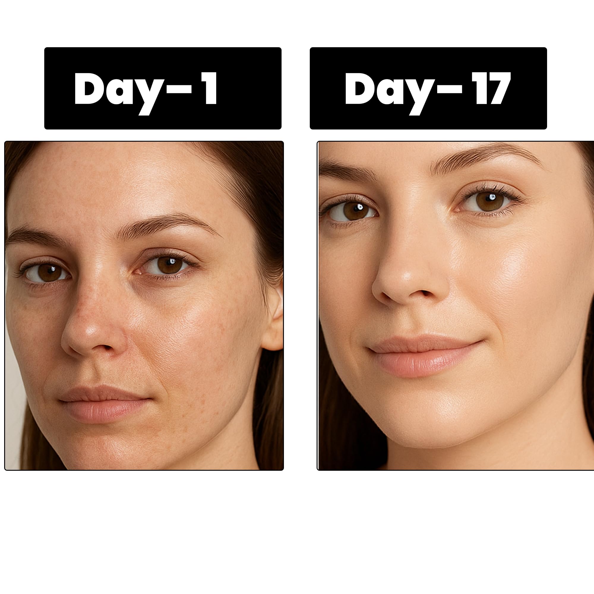 Plaxora Vitamin C + Arbutin + Copper Peptides Serum – 17% Brightening + Barrier Boost Complex for Radiant, Firm Skin – Anti-Aging Face Serum Boosts Collagen & Elasticity | Non-Comedogenic, 1 Fl Oz